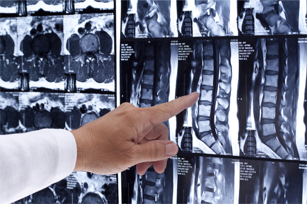 How Can A Chiropractor Fix Back Pain?