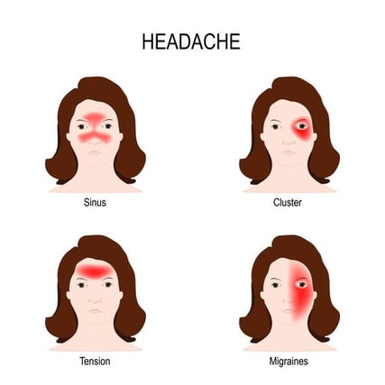 Cluster, Tension, Sinus, Migraine Headaches