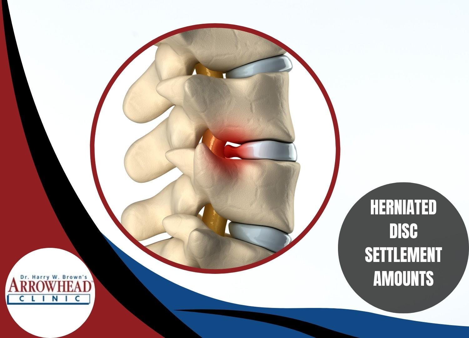 herniated disc injury from auto accident